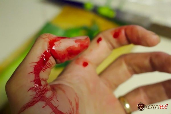 Chiêm bao người khác bị đứt tay chảy máu có thể là điềm xấu