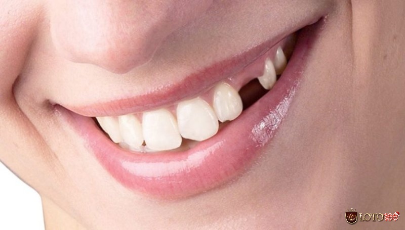 Mơ thấy rụng răng là điềm báo tốt hay xấu và ý nghĩa ra sao?